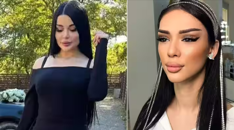 Model (22) stirbt bei Po-Vergrößerung! Tragischer Tod bei Operation, sie wollte noch schöner sein!